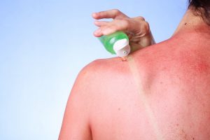First Aid Tips for Summer
